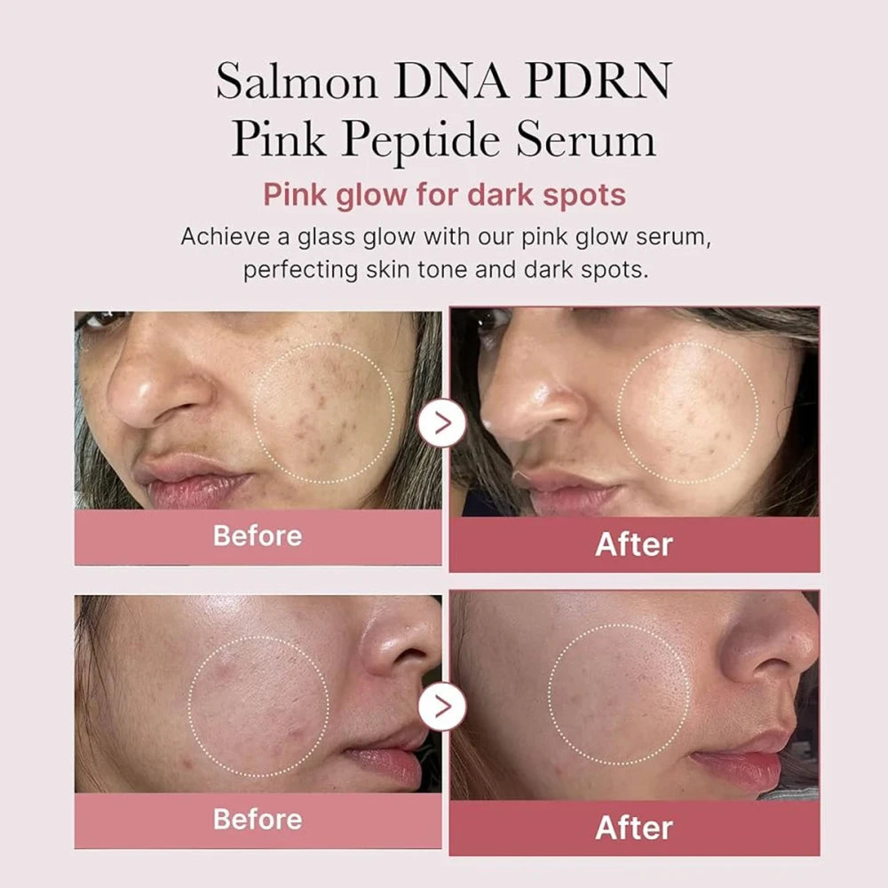 Salmon DNA Pink Peptide Serum